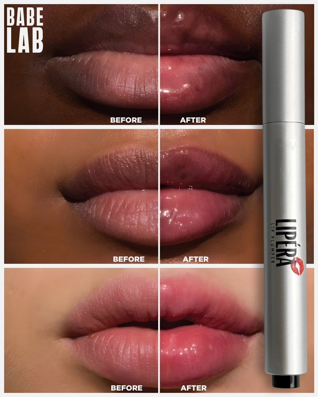 LIPÉRA KOREAN LIP PLUMPER