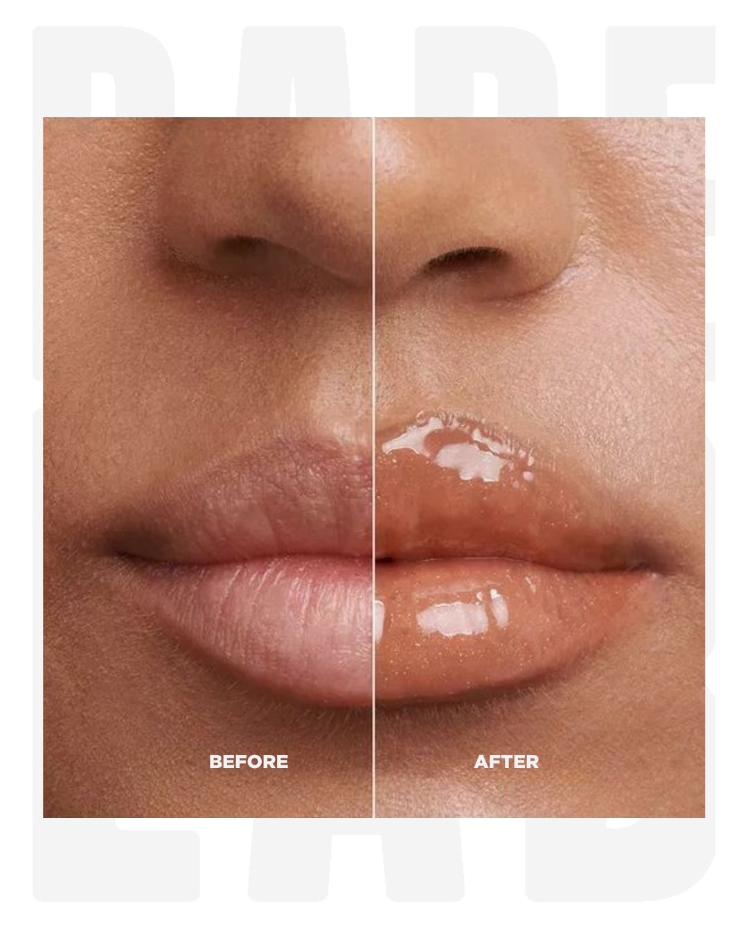 LIPÉRA KOREAN LIP PLUMPER